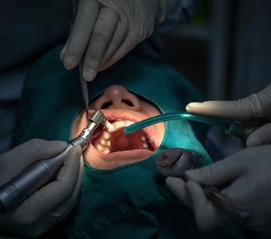 closeup dentist assistant operating checking teeth cleaning dental clinic_41418 2911