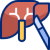 hepatectomy_13893726 1